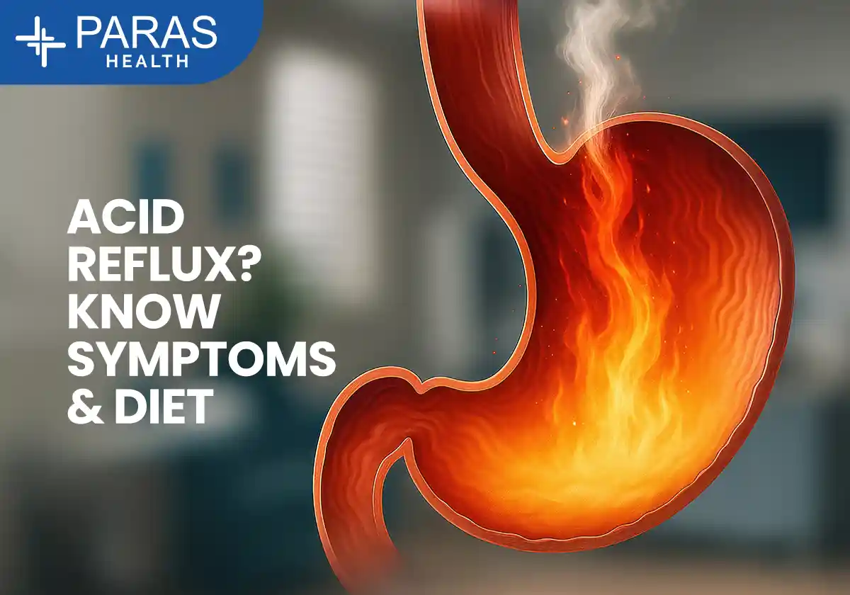 Acid Reflux: Symptoms, Causes, Treatment & Prevention